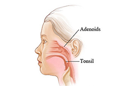 Adenoids Services